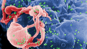 A microscope image of the HIV virus. (Courtesy CDC)