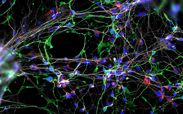 Williams syndrome-derived neurons in culture. (Credit: UC San Diego)