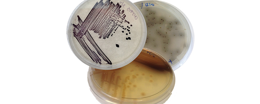 Cultures of three marine bacteria that make the compound pentabromopseudilin. (Courtesy Scripps Institution of Oceanography)