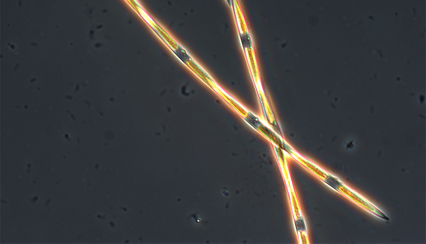 Microscopic view of domoic acid producing Pseudo-nitzschia diatom. (Credit: G. Jason Smith at Moss Landing Marine Labs)