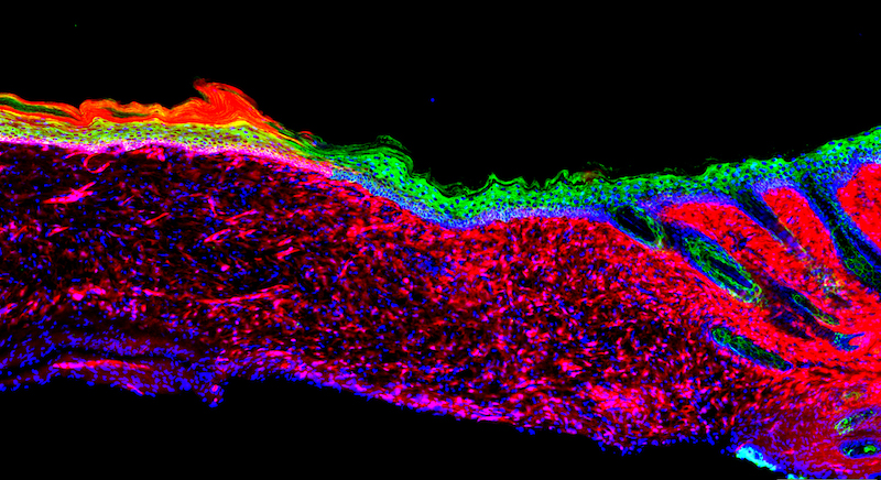 The image represents the first proof of principle for the successful regeneration of a functional organ (the skin) inside a mammal, by a technique known as AAV-based in vivo reprogramming. (Credit: Salk Institute)