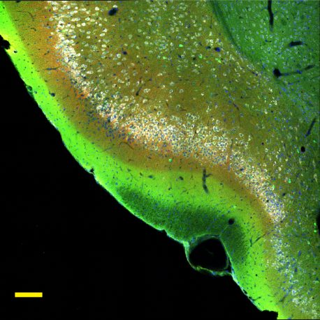 The image shows a section of the front part of the piriform cortex, an area of the brain involved in the sense of smell. (Credit: Salk Institute)