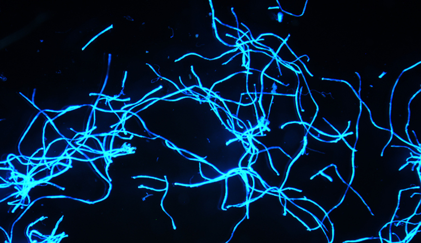 Microfibers fluorescing under a microscope. (Image courtesy of Scripps Institution of Oceanography)