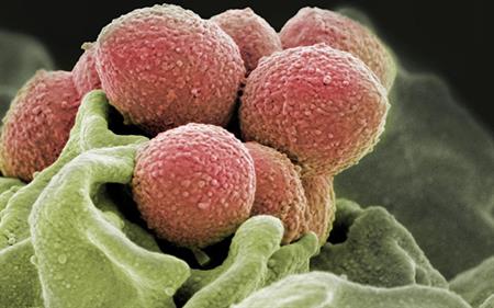 A colorized scanning electron micrograph of Group A Streptococcus bacteria (pink). (Image courtesy of NIH National Institute of Allergy and Infectious Diseases)