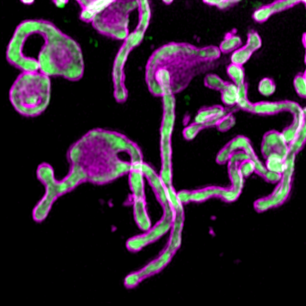 The microprotein PIGBOS (magenta) shown sitting on the outer membranes of mitochondria (green), where it is poised to make contact with other organelles in the cell. (Credit: Salk Institute/Waitt Advanced Biophotonics Core Facility)