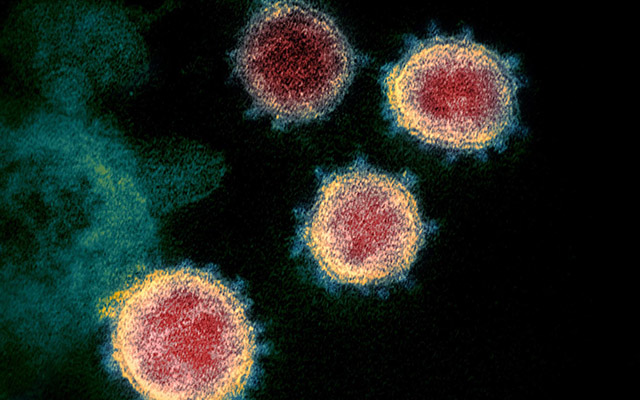 A colorized scanning electron micrograph of the SARS-CoV-2 virus. (Credit: NIAID)