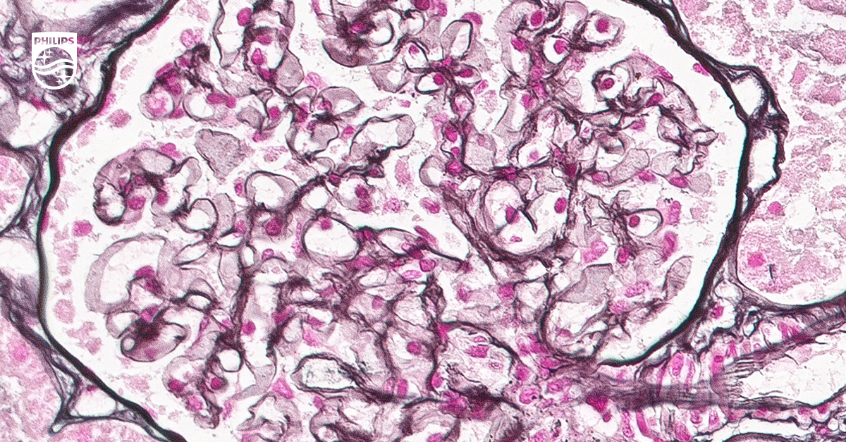 digital image of scanned tissue slide.