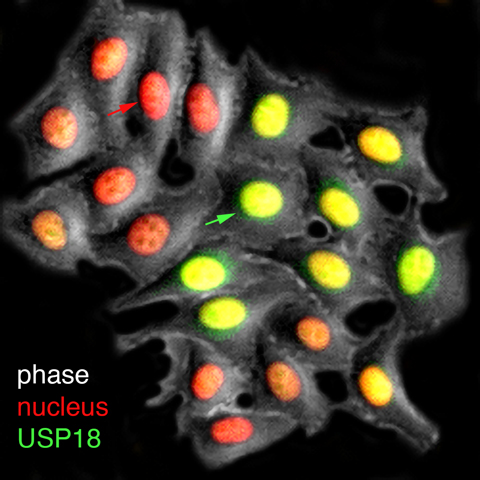A live-cell visualization of the production of USP18 (green), the inhibitory factor that mediates cell refractorines—or loss of sensitivity—to interferon treatments.