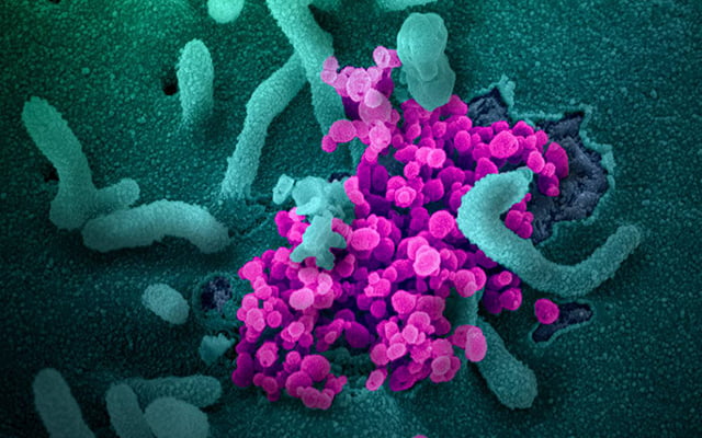 (PHOTO) False color scanning electron micrograph of SARS-CoV-2 virus, which causes COVID-19. Photo credit: NIAID.