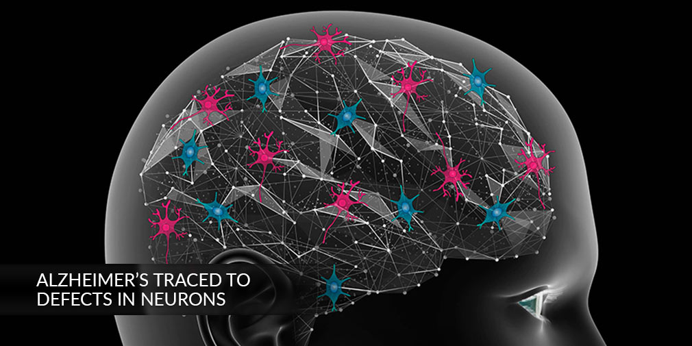 Alzheimer's neurons mechanisms. (Courtesy UC San Diego)