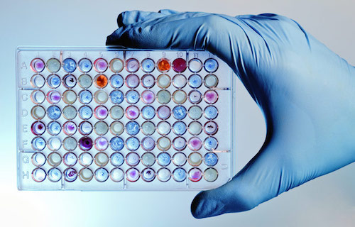 Microplate with color samples.(Courtesy of Sanford Burnham Prebys Medical Discovery Institute)