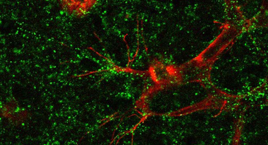 In a new study, scientists test a possible new therapy for eye diseases that's based on fragments of the CITED2 protein. Here, the protein interacts with tips of blood vessels in the retina. (Image by Ayumi Usui-Ouchi, Friedlander laboratory at Scripps Research.)