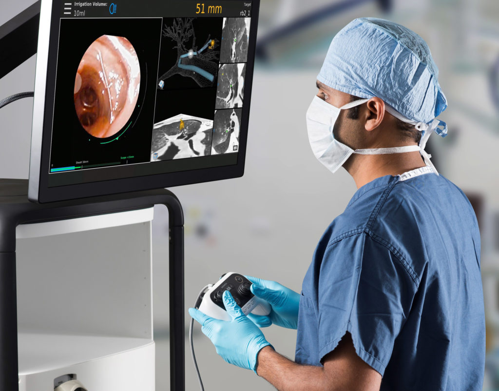 Scripps robotic bronchoscopy