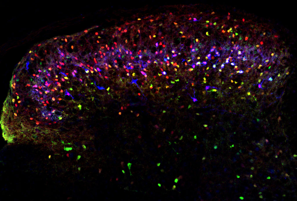 The researchers studied the organization of interneurons in the spinal cord, like those shown here. (Credit: Salk Institute)